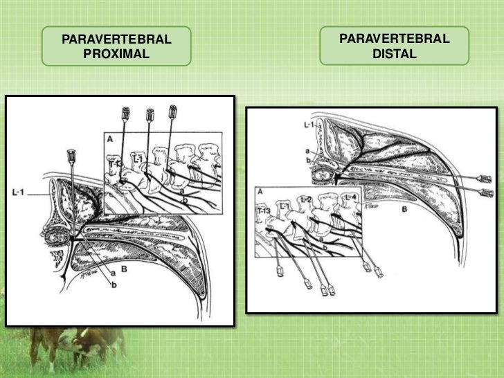 anestesia epidural en bovinos